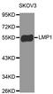 PDZ And LIM Domain 7 antibody, MBS127181, MyBioSource, Western Blot image 