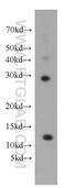 DET1 And DDB1 Associated 1 antibody, 14995-1-AP, Proteintech Group, Western Blot image 
