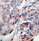Janus Kinase 2 antibody, abx000422, Abbexa, Western Blot image 
