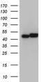 Heterogeneous nuclear ribonucleoprotein H antibody, TA810901, Origene, Western Blot image 