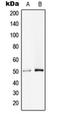 Putative serine/threonine-protein phosphatase 4 regulatory subunit 1-like antibody, orb215215, Biorbyt, Western Blot image 