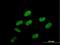 Phosphorylated CTD-interacting factor 1 antibody, H00063935-B01P, Novus Biologicals, Immunocytochemistry image 