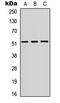 SMAD Family Member 3 antibody, LS-C358326, Lifespan Biosciences, Western Blot image 