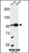 Centrosome and spindle pole-associated protein 1 antibody, 63-921, ProSci, Western Blot image 