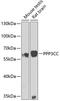 Protein Phosphatase 3 Catalytic Subunit Gamma antibody, GTX55755, GeneTex, Western Blot image 