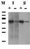 Small Glutamine Rich Tetratricopeptide Repeat Containing Alpha antibody, GTX632697, GeneTex, Western Blot image 