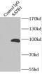 Protein strawberry notch homolog 1 antibody, FNab07618, FineTest, Immunoprecipitation image 