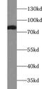Acetoacetyl-CoA Synthetase antibody, FNab00016, FineTest, Western Blot image 