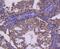 Ret Proto-Oncogene antibody, NBP2-67734, Novus Biologicals, Immunohistochemistry paraffin image 
