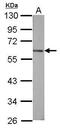 GC Vitamin D Binding Protein antibody, PA5-29082, Invitrogen Antibodies, Western Blot image 