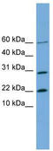 Proline-rich protein 13 antibody, TA344858, Origene, Western Blot image 