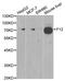 Coagulation Factor XII antibody, orb48369, Biorbyt, Western Blot image 