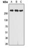 Insulin Like Growth Factor 2 Receptor antibody, LS-C359020, Lifespan Biosciences, Western Blot image 
