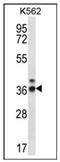 Ribonuclease P/MRP Subunit P38 antibody, AP53729PU-N, Origene, Western Blot image 