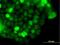 Zinc Finger Protein 415 antibody, H00055786-B01P, Novus Biologicals, Immunocytochemistry image 