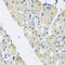 Aminolevulinate Dehydratase antibody, A03122, Boster Biological Technology, Immunohistochemistry paraffin image 
