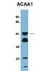 Acetyl-CoA Acyltransferase 1 antibody, NBP1-55156, Novus Biologicals, Western Blot image 