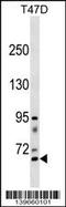 Rhophilin Rho GTPase Binding Protein 2 antibody, 60-441, ProSci, Western Blot image 