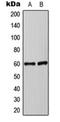 Synaptotagmin 1 antibody, orb224182, Biorbyt, Western Blot image 