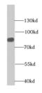 Chondroitin Polymerizing Factor antibody, FNab01669, FineTest, Western Blot image 