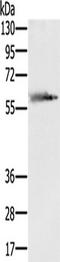 SLC29A4 antibody, TA350425, Origene, Western Blot image 