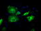 SDH antibody, TA500701, Origene, Immunofluorescence image 