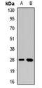 C-Type Lectin Domain Containing 7A antibody, orb412919, Biorbyt, Western Blot image 