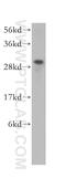 HUS1 Checkpoint Clamp Component antibody, 11223-1-AP, Proteintech Group, Western Blot image 