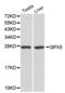 Epididymal secretory glutathione peroxidase antibody, abx000998, Abbexa, Western Blot image 