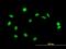 Zinc Finger BED-Type Containing 1 antibody, H00009189-B01P, Novus Biologicals, Immunofluorescence image 