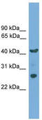 Transmembrane Protein 176A antibody, TA331855, Origene, Western Blot image 