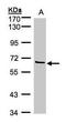 Coagulation Factor XI antibody, TA308541, Origene, Western Blot image 