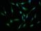 Bardet-Biedl Syndrome 7 antibody, orb418243, Biorbyt, Immunofluorescence image 