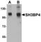 SH3 Domain Binding Protein 4 antibody, TA306780, Origene, Western Blot image 
