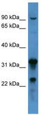 Coagulation Factor VIII antibody, TA342832, Origene, Western Blot image 