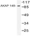 A-Kinase Anchoring Protein 1 antibody, AP20535PU-N, Origene, Western Blot image 