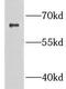 Growth Factor Receptor Bound Protein 14 antibody, FNab03641, FineTest, Western Blot image 