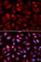 Acid Phosphatase 5, Tartrate Resistant antibody, LS-C332141, Lifespan Biosciences, Immunofluorescence image 