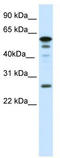 Forkhead Box D1 antibody, TA341772, Origene, Western Blot image 