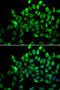 Alsin Rho Guanine Nucleotide Exchange Factor ALS2 antibody, MBS129798, MyBioSource, Immunofluorescence image 