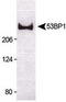 p53BP1 antibody, TA309917, Origene, Western Blot image 