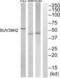 Histone-lysine N-methyltransferase SUV39H2 antibody, abx015105, Abbexa, Western Blot image 