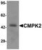 Cytidine/Uridine Monophosphate Kinase 2 antibody, NBP2-82045, Novus Biologicals, Western Blot image 