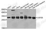 Capping Actin Protein Of Muscle Z-Line Subunit Beta antibody, A8106, ABclonal Technology, Western Blot image 