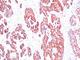 Keratin 76 antibody, NBP2-44439, Novus Biologicals, Immunohistochemistry frozen image 