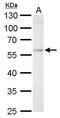 GBA antibody, PA5-22326, Invitrogen Antibodies, Western Blot image 