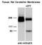 Metabotropic Glutamate Receptor 2 & 3 antibody, NB100-1760, Novus Biologicals, Western Blot image 
