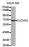 Sodium-dependent phosphate transporter 2 antibody, MBS126650, MyBioSource, Western Blot image 