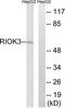 RIO Kinase 3 antibody, TA314808, Origene, Western Blot image 
