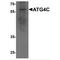 Autophagy Related 4C Cysteine Peptidase antibody, TA349076, Origene, Western Blot image 